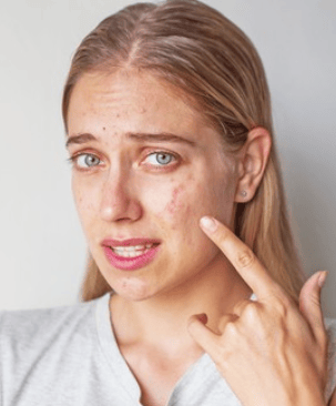 Which foundation formula is right for your skin?